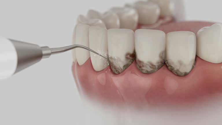 Trusted Teeth Cleaning And Checkup service in Springfield, KY - Dentist Open Now